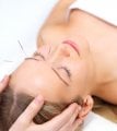 Effective Acupuncture Treatment and Cupping Therapy at Jayanth Clinic - Chennai
