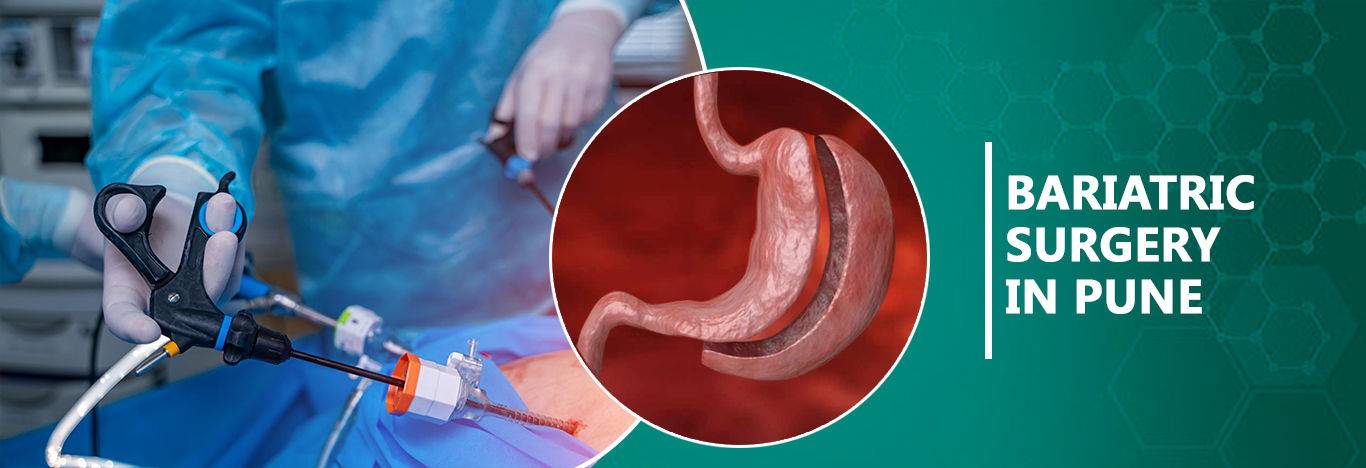 Best Bariatric Surgeon in Pune | Bariatric Surgery | Dr. Samrat Jankar