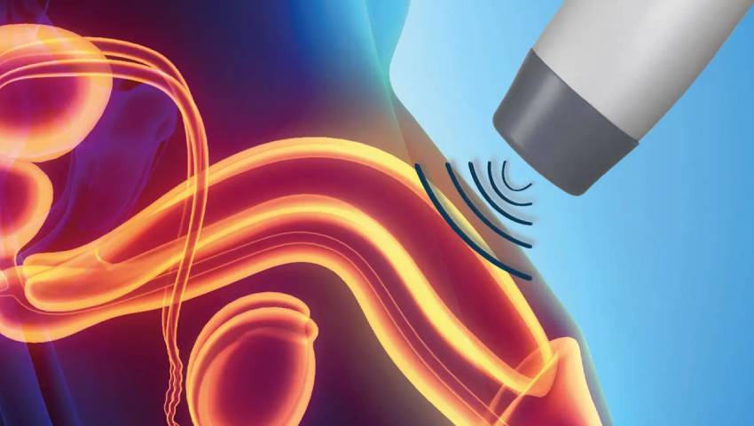 Shockwave Therapy for Erectile Dysfunction in Pune - Dr. Akhil S Mane